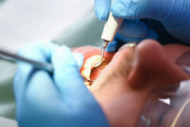 Best Broken or Chipped Tooth Repair in Winfield, TN