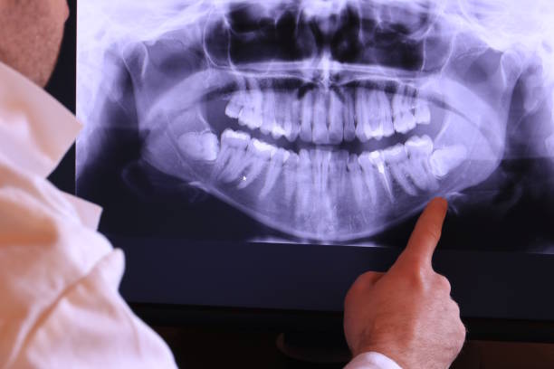 Best Emergency Treatment for Oral Infections in Winfield, TN